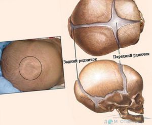 Быстро зарастает родничок у ребенка