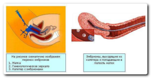 Месячные после переноса эмбрионов