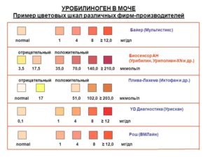 Следы уробилиноген в моче