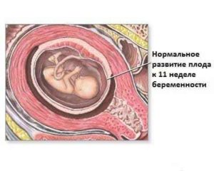 11 неделя беременности простуда