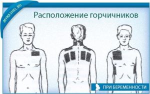 Можно ли ставить горчичники при беременности 3 триместр