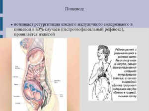 Изменения в жкт при беременности