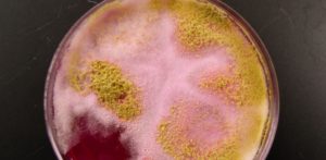 Escherichia coli у беременных