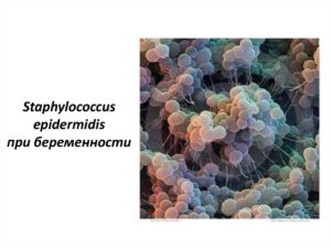 Стафилококк эпидермальный при беременности