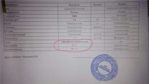 Соль в моче при беременности что это значит