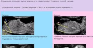 Можно ли определить пол ребенка в 10 недель