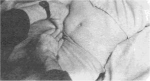 Пальпация яичников у женщин