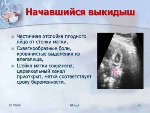Отслойка плодного яйца на ранних сроках беременности последствия