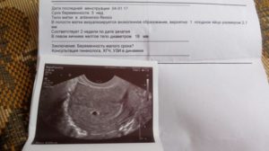 Может ли узи показать беременность на 2 недели