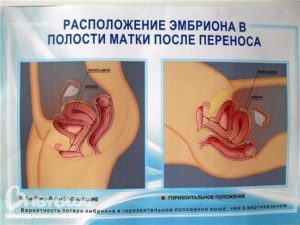 Месячные после переноса эмбрионов