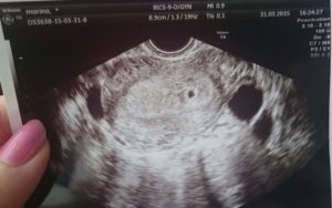 Узи на 4 недели беременности не видно эмбриона