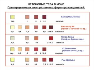 Кетоны в моче при беременности что это значит