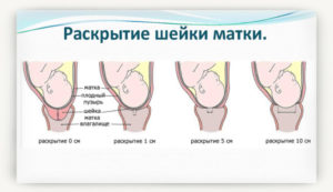 Как понять что матка открывается перед родами