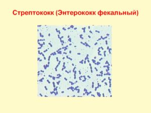 Стрептококк фекальный при беременности