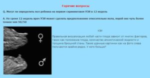Можно ли на 12 недели узнать пол ребенка