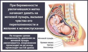 Ноет матка при беременности