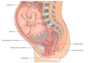Расположение матки при беременности