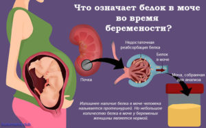 От чего у беременных появляется в моче белок