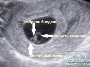 На какой неделе беременности виден эмбрион на узи