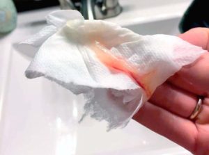 После родов розовые выделения