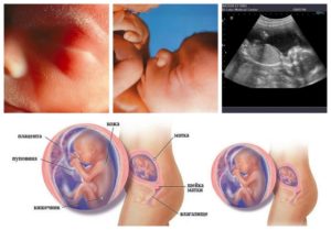 19 недель беременности что происходит