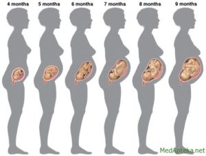 9 месяц беременности схватки симптомы как определить