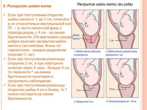 Почему не раскрылась шейка матки во время родов
