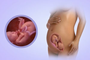 Плод в 25 недели беременности