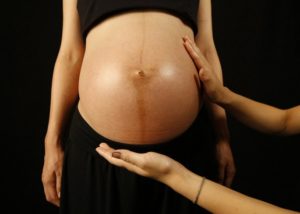 Полоса у беременных на животе