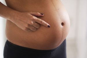 Полоса у беременных на животе