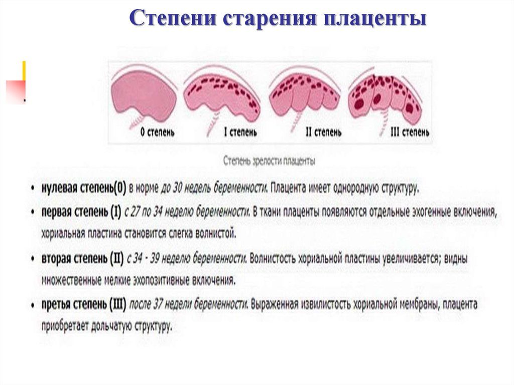 Степени старения плаценты по неделям