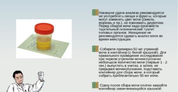 Что кушать перед сдачей мочи при беременности