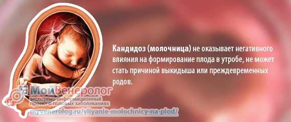 Кандида у беременных. Молочница влияет на беременность. Молочница у беременной 3 триместр. Молочница неделе беременности. Кандидоза при беременности 3 триместр.