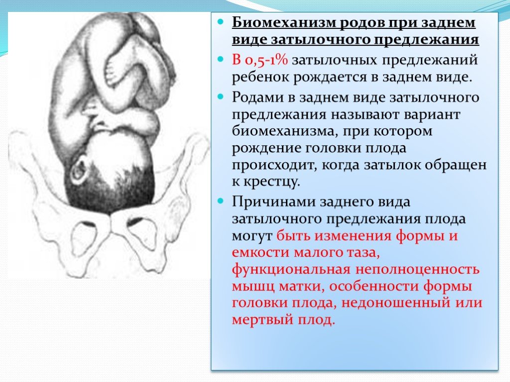 План ведения родов при головном предлежании