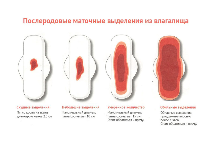 Мало выделений после родов