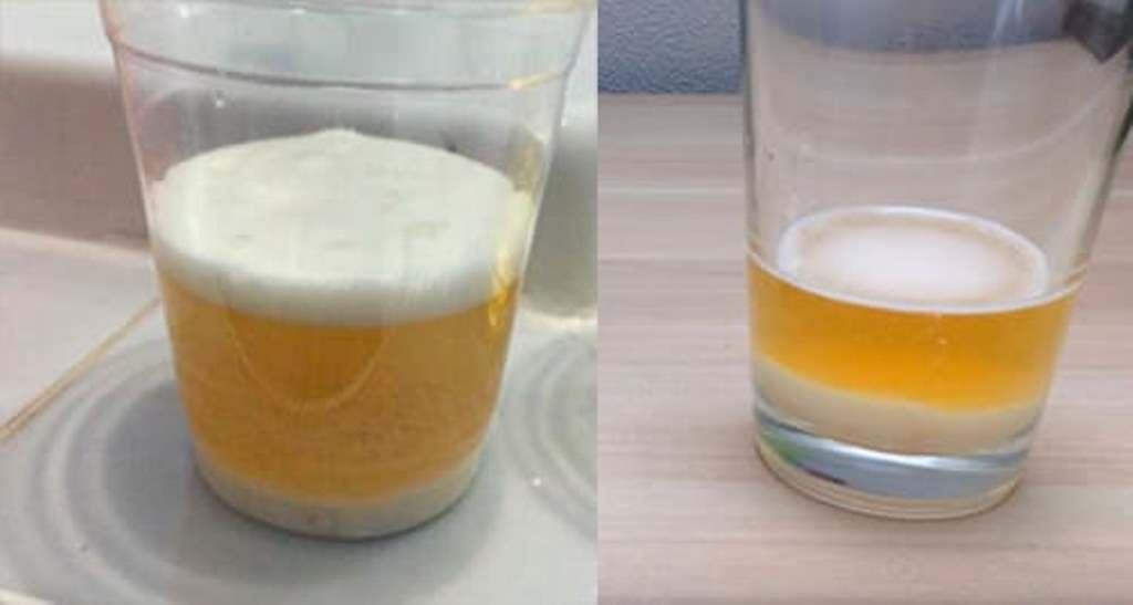 Тест на беременность домашних условиях с содой. Сода и моча. Тест на беременность с содой. Сода и моча тест. Реакция мочи на соду.