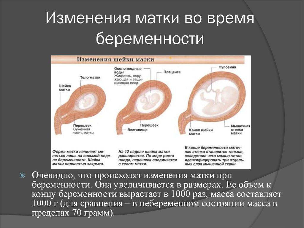 Где находится матка у беременных фото