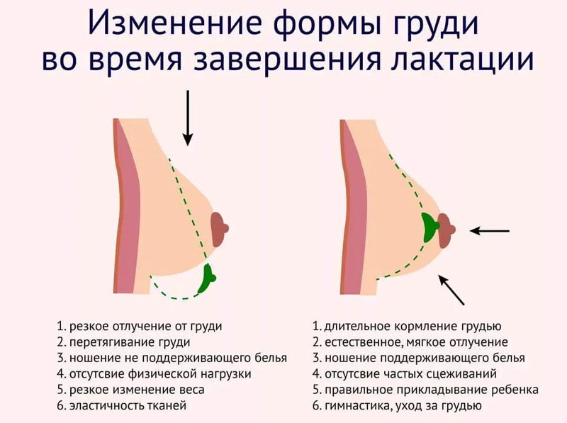 После кормления груди разные