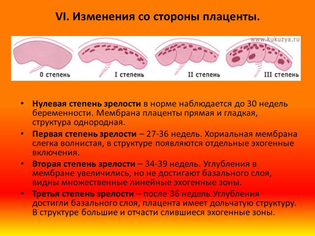 Плацента 2 3 степени