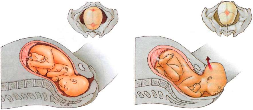 Роды через матку. Период раскрытия шейки матки. Расположение ребенка перед родами. Расположение плода перед родами.