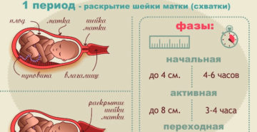 Срок родов прошел а родов нет что делать