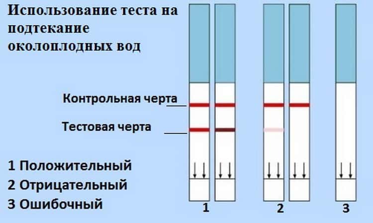 Как распознать подтекание околоплодных вод в домашних условиях