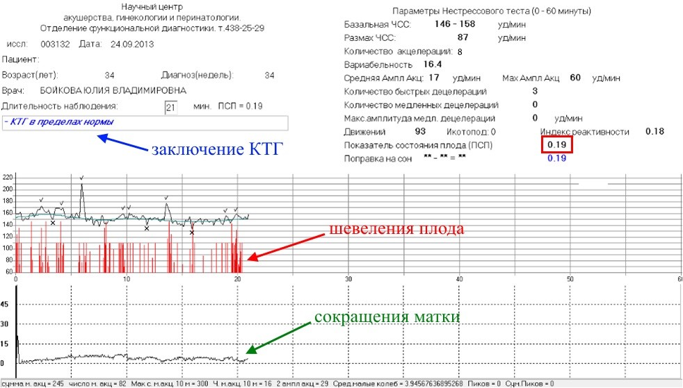 Шевеления плода на 39 неделе беременности норма