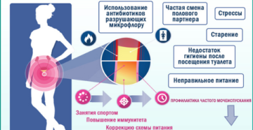 Боль в конце мочеиспускания после родов