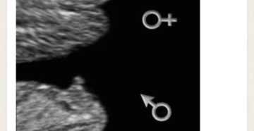 Можно ли определить пол ребенка на 12 недели