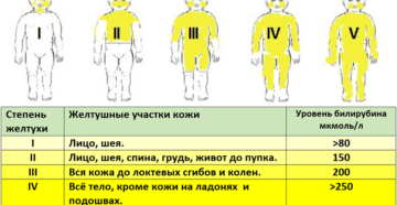 Желтушка у новорожденных сколько длится