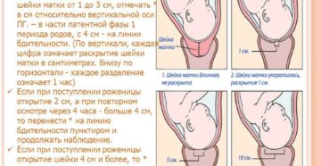 За сколько дней до родов открывается шейка матки