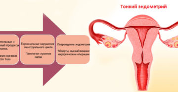 Тонкая матка при беременности