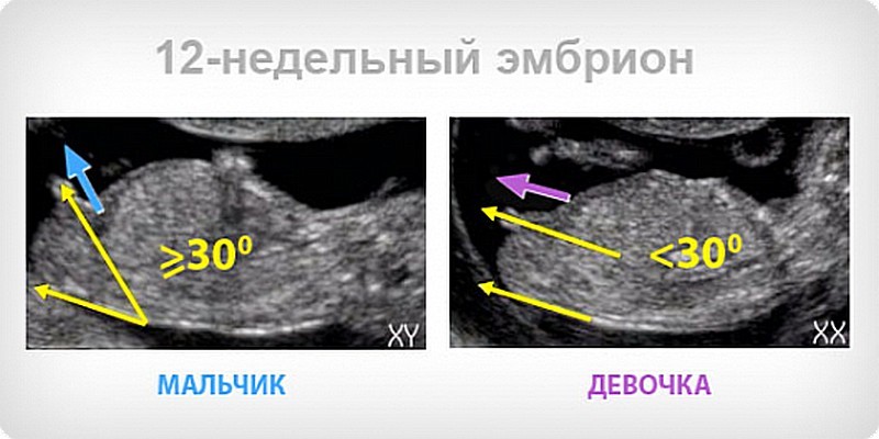 Узнать пол по фото