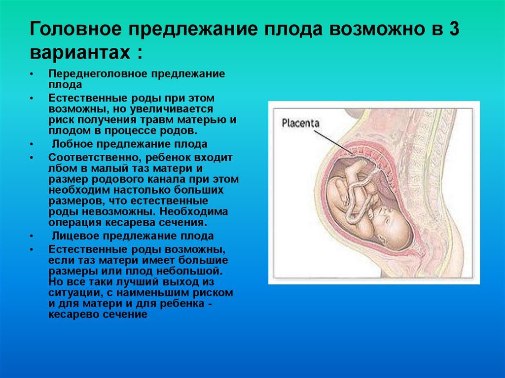 Что значит продольное предлежание плода головное предлежание